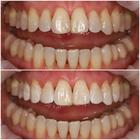 Пример работы до и после - 