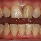 Пример работы до и после - 