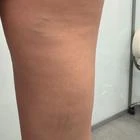 Пример работы до и после - 