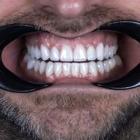 Пример работы до и после - 