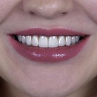 Пример работы до и после - 