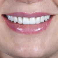 Пример работы до и после - 