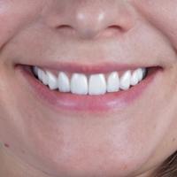 Пример работы до и после - 