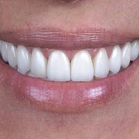 Пример работы до и после - 