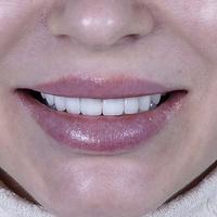 Пример работы до и после - 