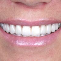 Пример работы до и после - 