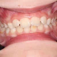 Пример работы до и после - 