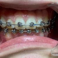 Пример работы до и после - 