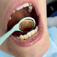 Пример работы до и после - 