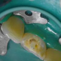 Пример работы до и после - 