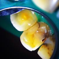 Пример работы до и после - 