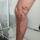 Пример работы до и после - 