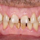 Пример работы до и после - 