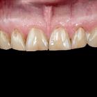 Пример работы до и после - 