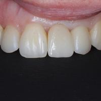 Пример работы до и после - 