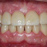 Пример работы до и после - 