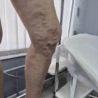 Пример работы до и после - 