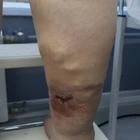 Пример работы до и после - 