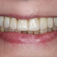 Пример работы до и после -