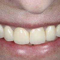 Пример работы до и после -