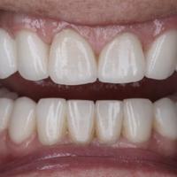 Пример работы до и после -