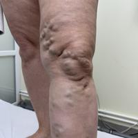 Пример работы до и после -