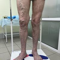 Пример работы до и после -