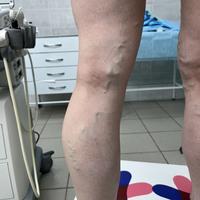 Пример работы до и после -