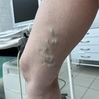 Пример работы до и после -