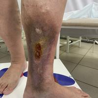 Пример работы до и после -