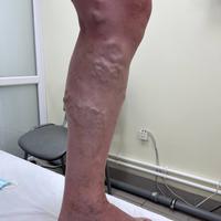 Пример работы до и после -