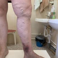 Пример работы до и после -