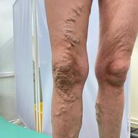 Пример работы до и после -