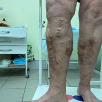 Пример работы до и после -