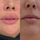 Пример работы до и после - 