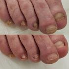 Пример работы до и после - 