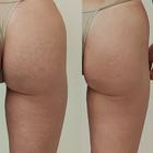 Пример работы до и после - 