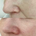 Пример работы до и после - 