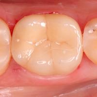 Пример работы до и после - 