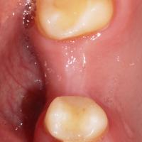 Пример работы до и после - 