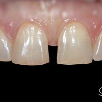 Пример работы до и после - 