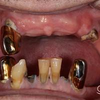 Пример работы до и после - 