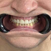 Пример работы до и после - 