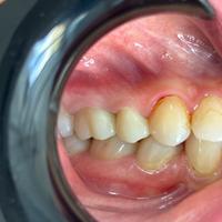 Пример работы до и после - 