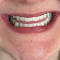 Пример работы до и после - 