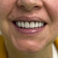 Пример работы до и после - 