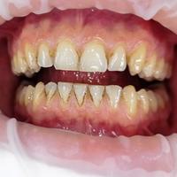 Пример работы до и после - 