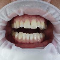 Пример работы до и после - 