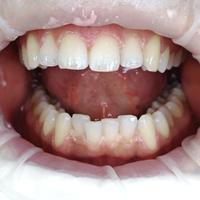 Пример работы до и после - 