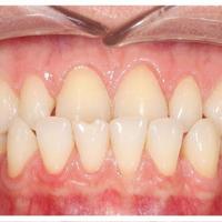 Пример работы до и после - 